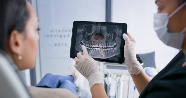 Licensed Tooth Extraction service in USA - Smile Center Dentistry